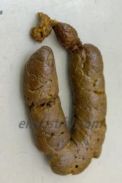 담낭 수술 후 강아지 변 상태 확인